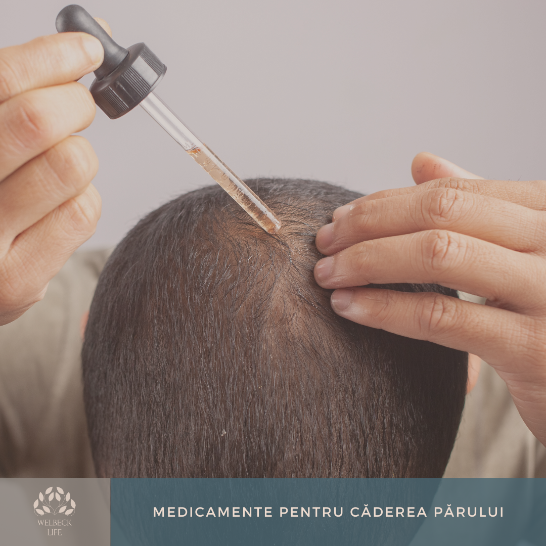 Medicamente pentru Caderea Parului Oradea