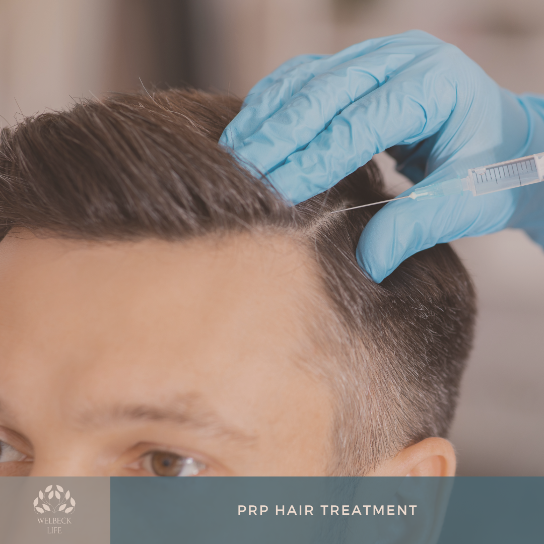PRP hair treatment London