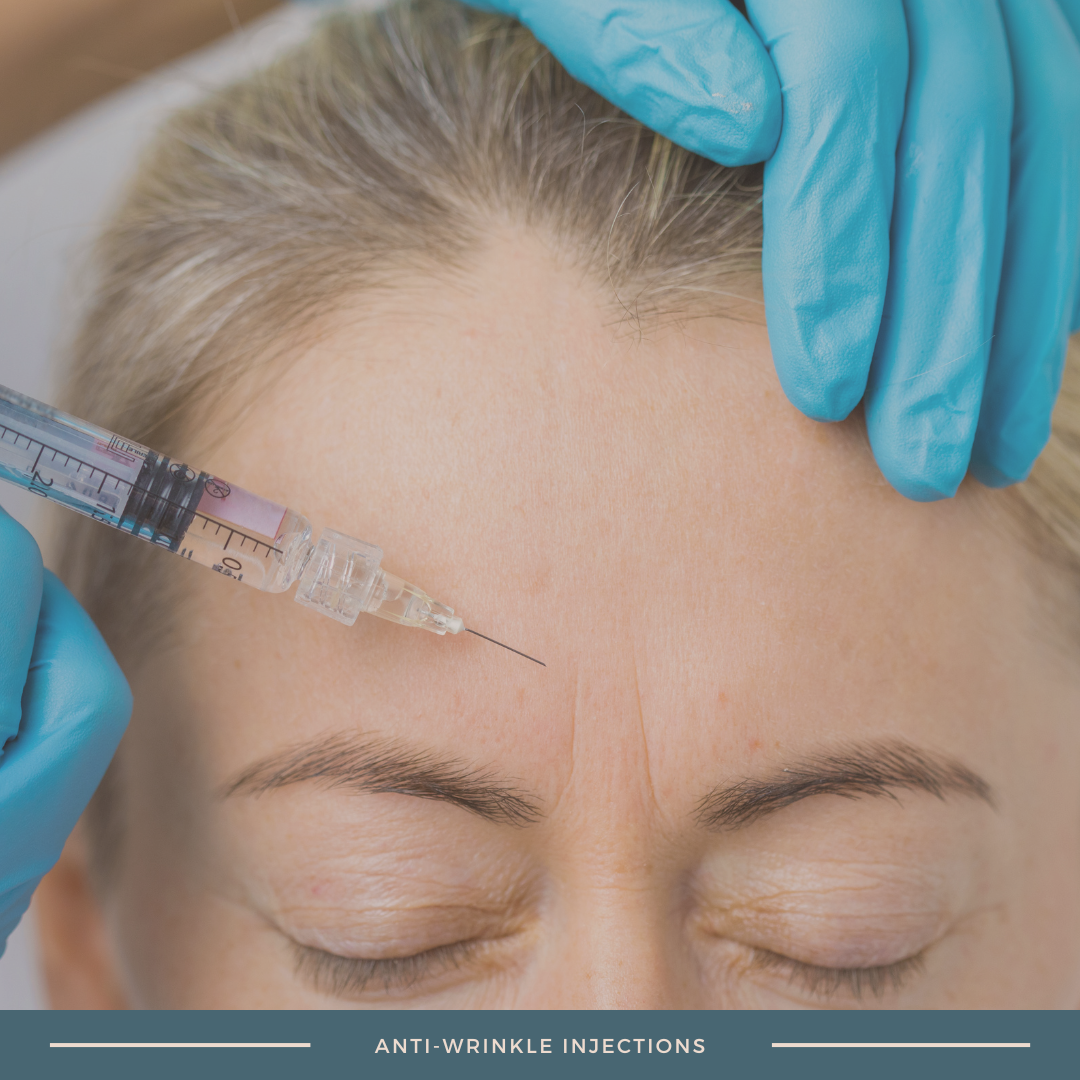 Anti-Wrinkle Treatments (Injections)