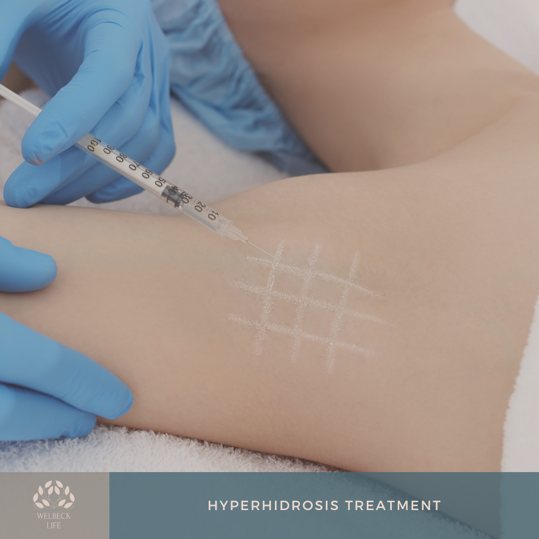 Hyperhidrosis treatment London