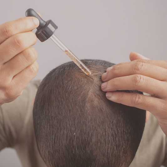 Medication for Hair Loss