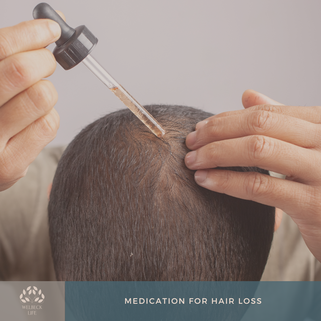 Medication for hair loss London