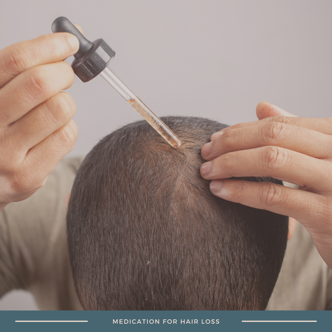 Medication for Hair Loss