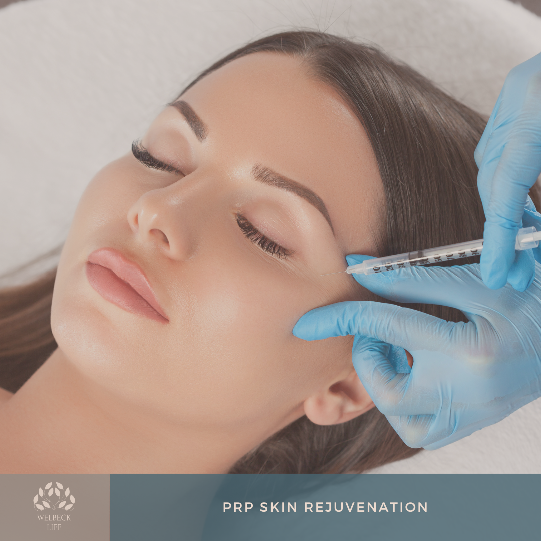 PRP skin rejuvenation London